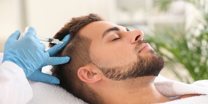 hair_transplantation