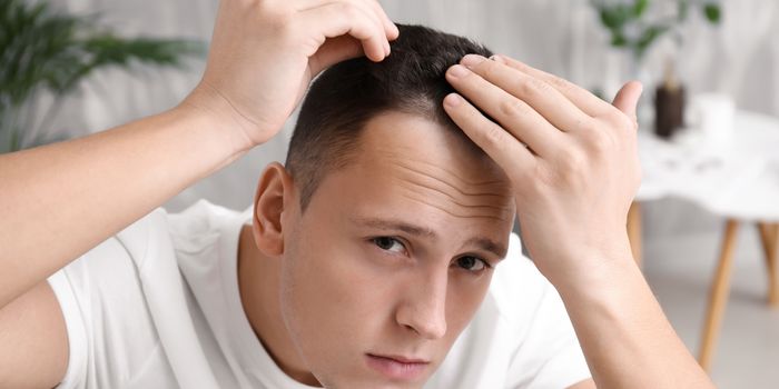 hair_loss