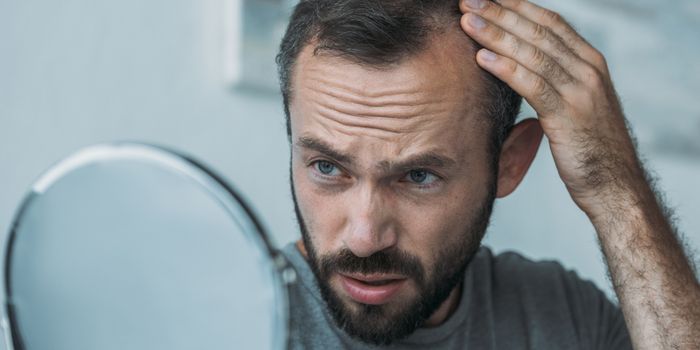 non-genetic_hair_loss