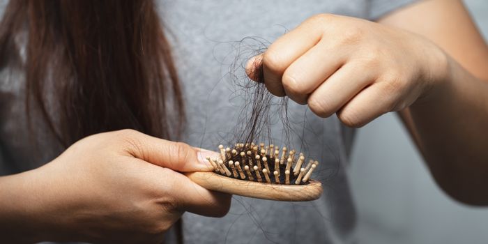 hair_loss_treatments_in_dubai